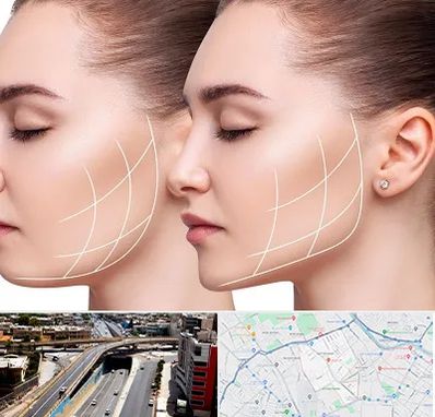 جراحی بوکال فت در ستارخان شیراز