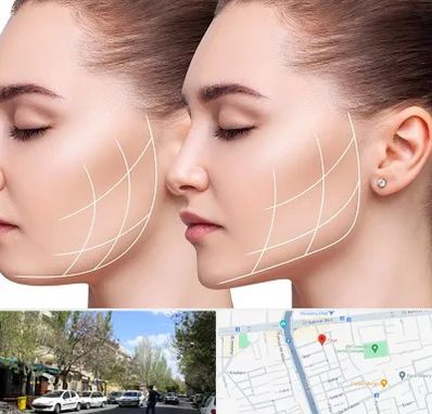 جراحی بوکال فت در کوی فیروز تبریز