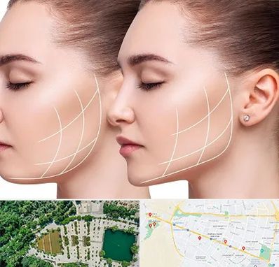 جراحی بوکال فت در وکیل آباد مشهد