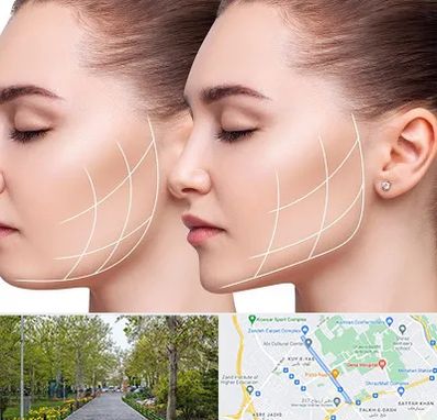 جراحی بوکال فت در قدوسی غربی شیراز