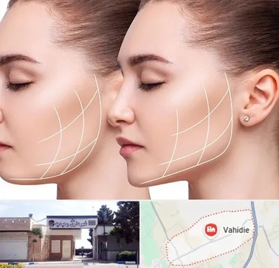 جراحی بوکال فت در وحیدیه شهریار