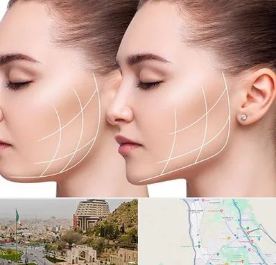 جراحی بوکال فت در فرهنگ شهر شیراز