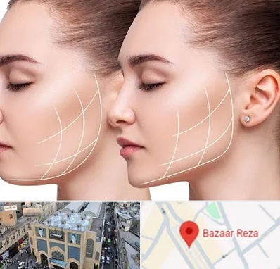 جراحی بوکال فت در بازار رضا مشهد