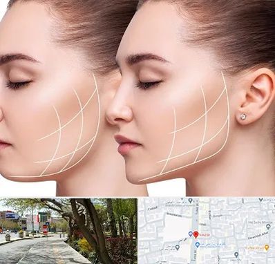 جراحی بوکال فت در خیابان توحید اصفهان