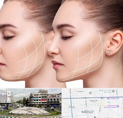 جراحی بوکال فت در مرکز تهران