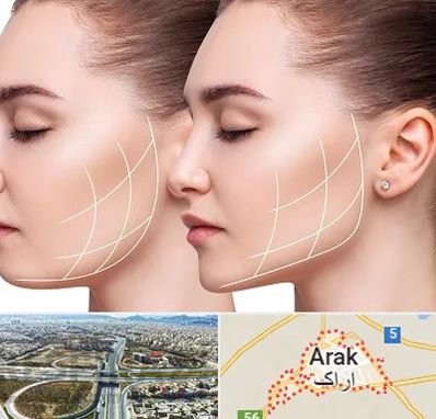 جراحی بوکال فت در اراک