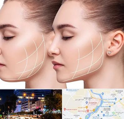 جراحی بوکال فت در کیانپارس اهواز