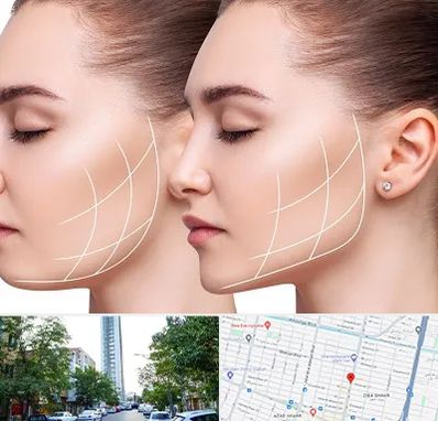 جراحی بوکال فت در امامت مشهد