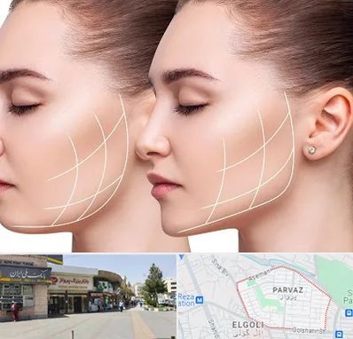 جراحی بوکال فت در پرواز تبریز