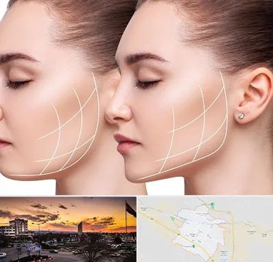 جراحی بوکال فت در قوچان