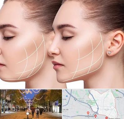 جراحی بوکال فت در ولیعصر ارومیه