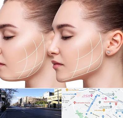 جراحی بوکال فت در خیابان ملاصدرا شیراز