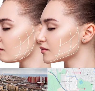 جراحی بوکال فت در سهند تبریز