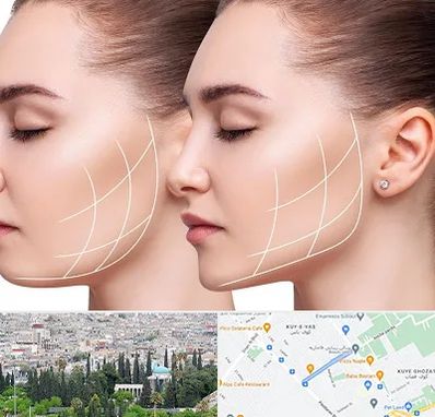 جراحی بوکال فت در محلاتی شیراز