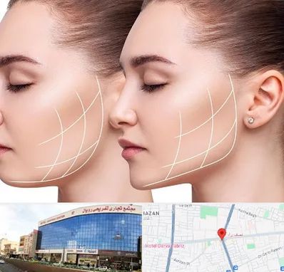 جراحی بوکال فت در نصف راه تبریز