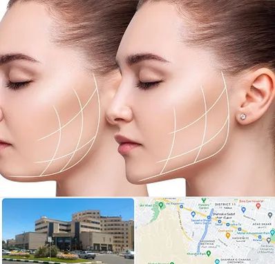 جراحی بوکال فت در صیاد شیرازی مشهد