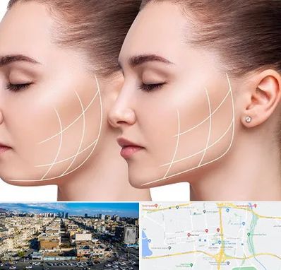 جراحی بوکال فت در شهرک راه آهن