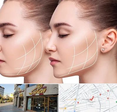 جراحی بوکال فت در عطاران قم