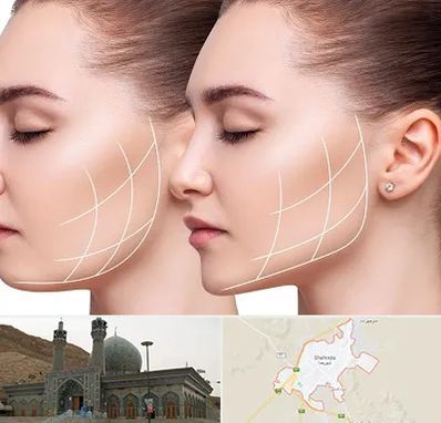 جراحی بوکال فت در شهرضا