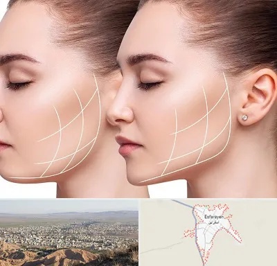 جراحی بوکال فت در اسفراین