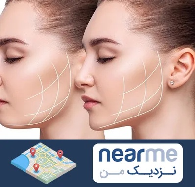 جراحی بوکال فت در نزدیک من