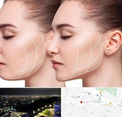 جراحی بوکال فت در هفت تیر مشهد