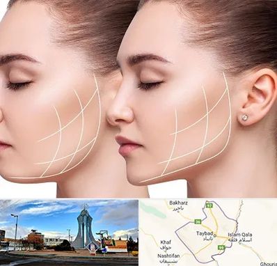 جراحی بوکال فت در تایباد