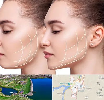 جراحی بوکال فت در مهاباد