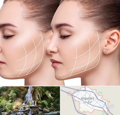 جراحی بوکال فت در الیگودرز