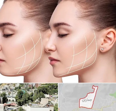 جراحی بوکال فت در جماران