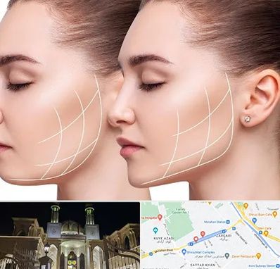 جراحی بوکال فت در زرگری شیراز