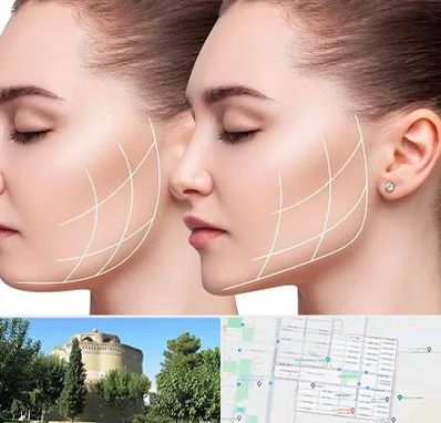 جراحی بوکال فت در مرداویج اصفهان