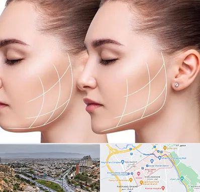 جراحی بوکال فت در معالی آباد شیراز