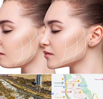 جراحی بوکال فت در خیابان نیایش شیراز