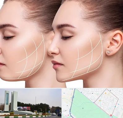 جراحی بوکال فت در بلوار فلسیطین مشهد