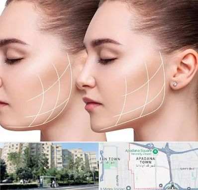 جراحی بوکال فت در آپادانا