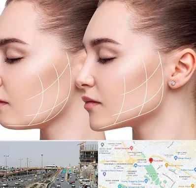 جراحی بوکال فت در بلوار توس مشهد