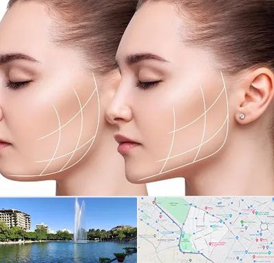 جراحی بوکال فت در کوهسنگی مشهد