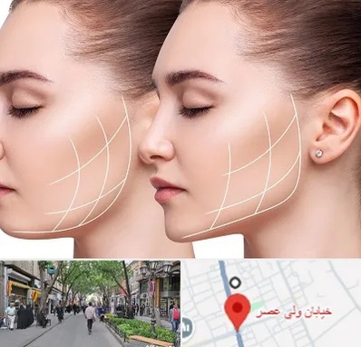 جراحی بوکال فت در ولیعصر شهریار