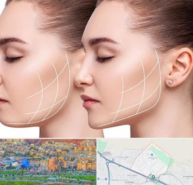 جراحی بوکال فت در رشدیه تبریز