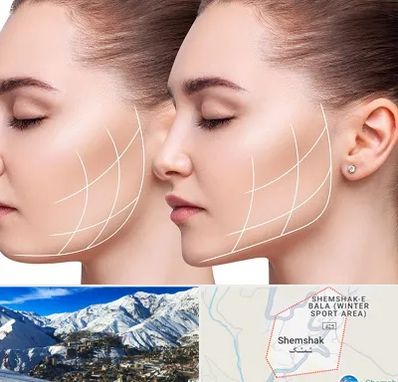 جراحی بوکال فت در شمشک