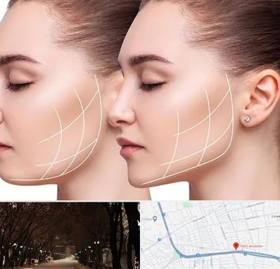 جراحی بوکال فت در ابوریحان تبریز