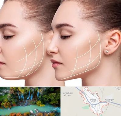 جراحی بوکال فت در دورود