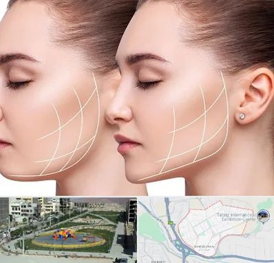 جراحی بوکال فت در مرزداران تبریز