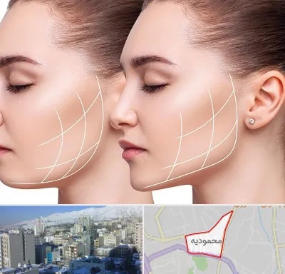 جراحی بوکال فت در محمودیه
