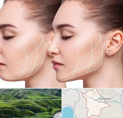 جراحی بوکال فت در گچساران