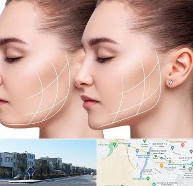 جراحی بوکال فت در شریعتی مشهد