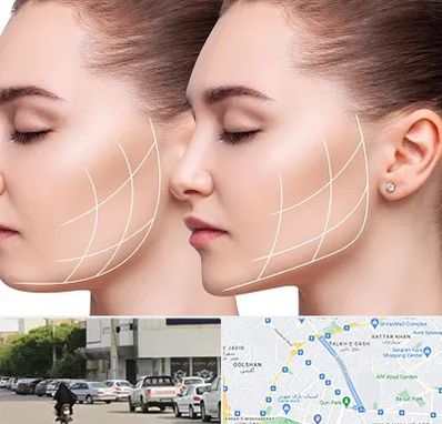 جراحی بوکال فت در قدوسی شرقی شیراز