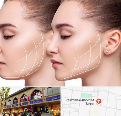 جراحی بوکال فت در 15 خرداد