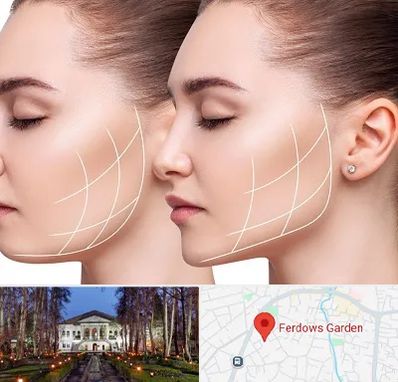 جراحی بوکال فت در باغ فردوس